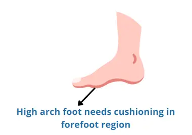 too high arches need cushioning under forefoot