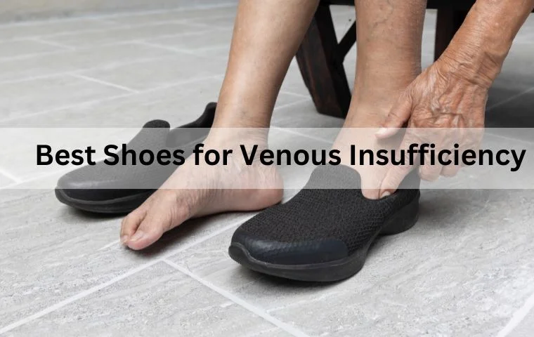 6 Best Shoes for Venous Insufficiency and Varicose Veins in 2024