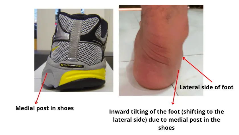 Shoes with a medial post can cause more stress on the lateral part of the foot with neutral arch